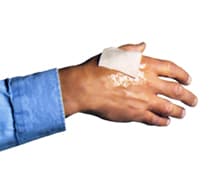 ForBurns Kompress 5x5 cm